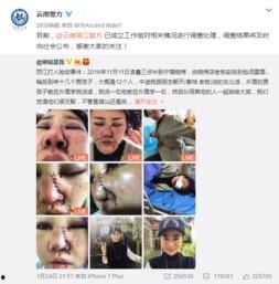 爆料博主毁容事件真相视频,爆料博主遭遇的惊人内幕  第2张 爆料博主毁容事件真相视频,爆料博主遭遇的惊人内幕  第2张